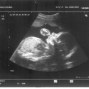 Фотографии УЗИ на 24-й неделе беременности