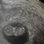 Фотографии УЗИ на 9-й неделе беременности