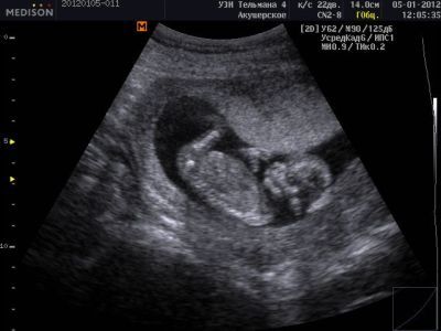 http://static3.babysfera.ru/6/0/6/b/48398137.400.jpeg