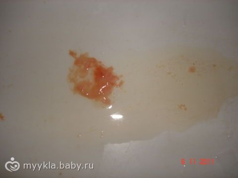 Вторые роды подтекают воды Вторые роды подтекают воды