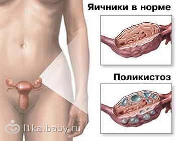 Какими средствами лечить лишай