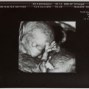 Фотографии УЗИ на 13-й неделе беременности