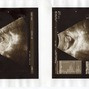 Фотографии УЗИ на 13-й неделе беременности