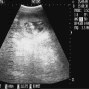 Фотографии УЗИ на 12-й неделе беременности