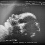 Фотографии УЗИ на 32-й неделе беременности