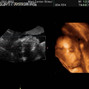 Фотографии УЗИ на 27-й неделе беременности