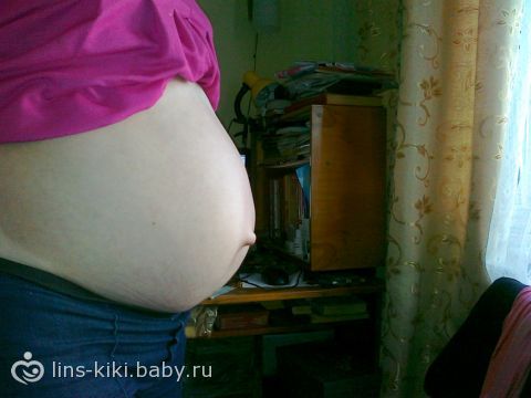 Если у беременной пупок наружу что это значит 31