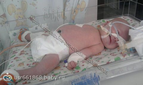Сбор закрыт. Малышу нужна помощь! Панасенко Богданчик (1 год, ДЦП, тетраперез)!